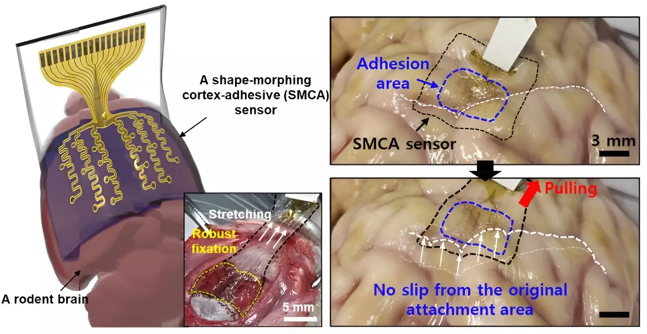 Advancements in Non-invasive Brain Treatment: The Future of Transcranial Focused Ultrasound