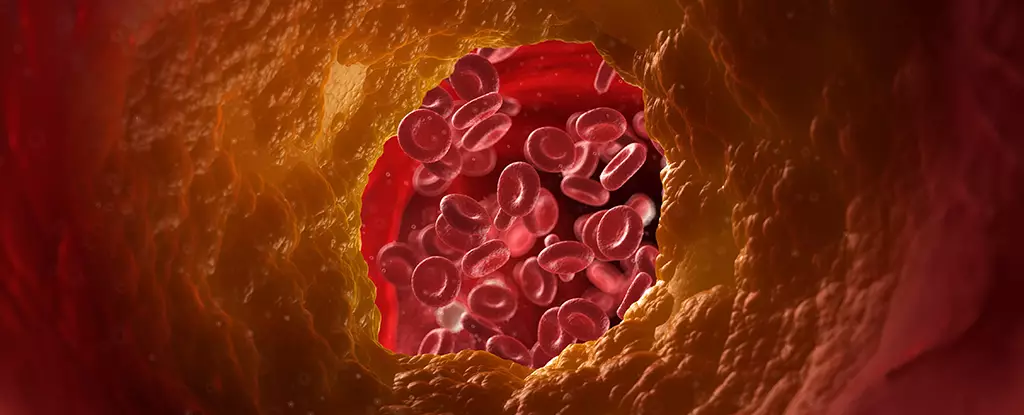 Revolutionizing Cardiovascular Health: The Promise of Nanoparticle Therapy