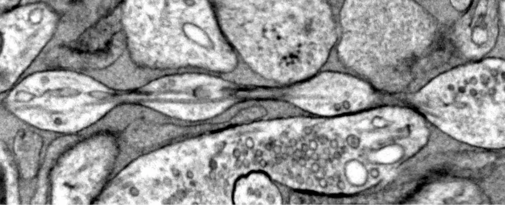 The Re-Evaluation of Axon Structure: A New Perspective on Neuroscience