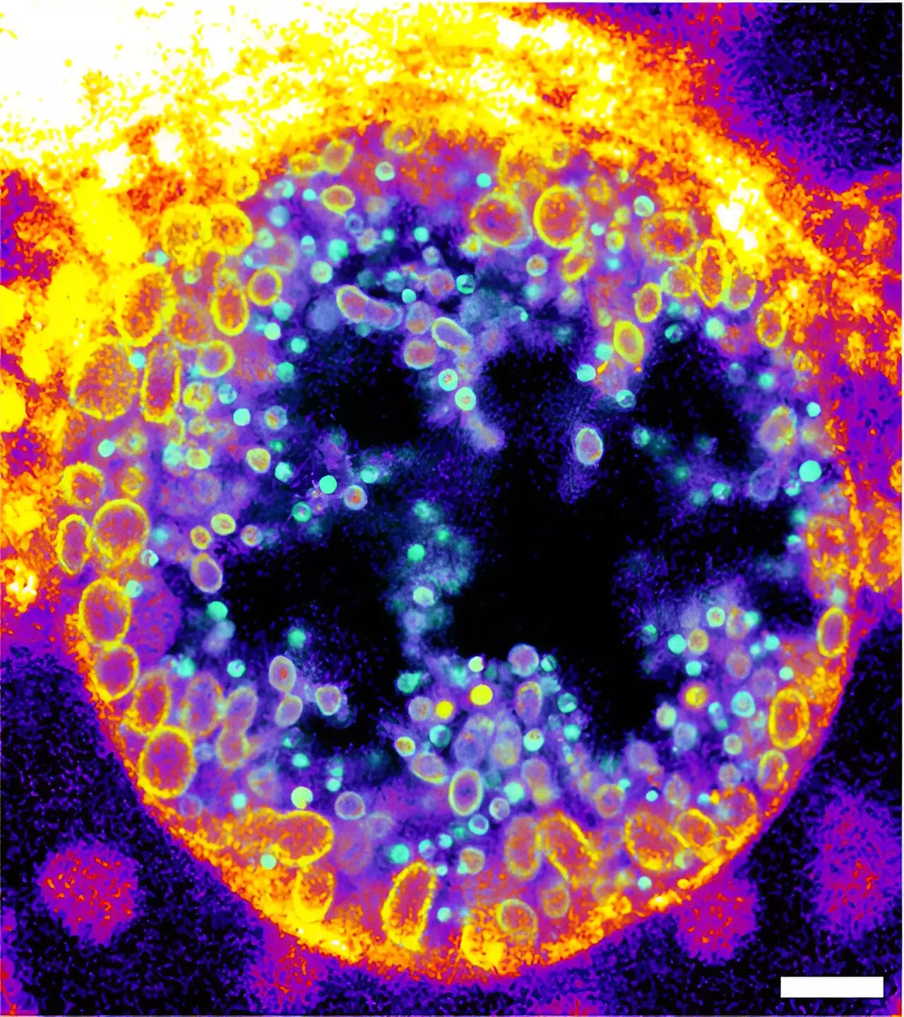 Innovative Insights into Sphingomyelin Metabolism: A Breakthrough in Infection Research