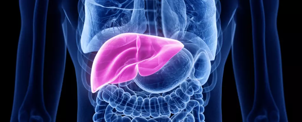 A Breakthrough in Liver Transplants: A New Hope for Advanced Bowel Cancer Patients