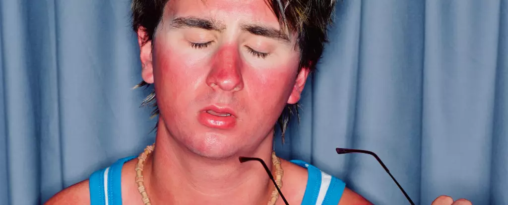 Redefining Our Understanding of Sunburn: Insights from Recent Research