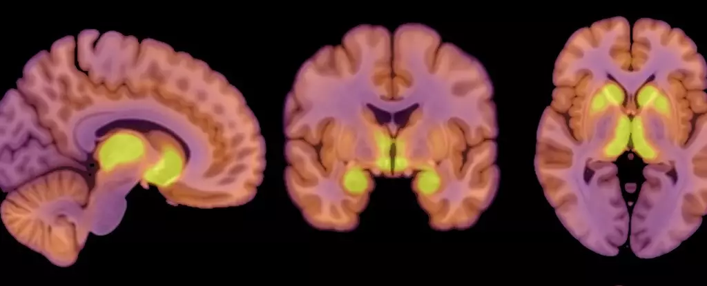 The Neurobiological Underpinnings of Anorexia Nervosa: Insights and Implications