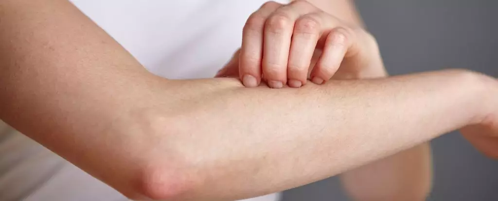 The Hidden Hero of the Skin: How Malassezia Yeast Fights Deadly Staph Infections