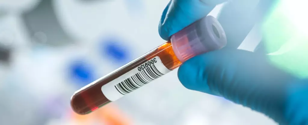 Revolutionizing Alzheimer’s Care: The Groundbreaking Blood Test
