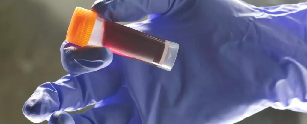 Unlocking the Hidden Stroke Risks in Blood Types: A Powerful Glimpse into Genetic Influence